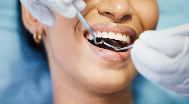 Best Emergency Treatment for Toothache in Oroville, CA